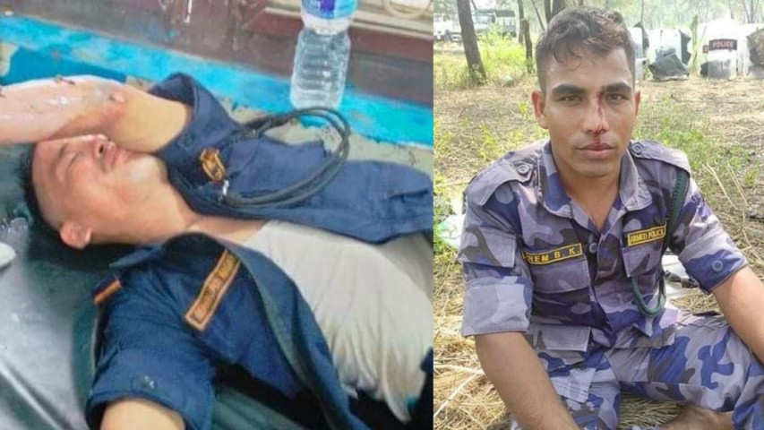 रूपन्देहीको मोतिपुर झडप : एसपीसहित ४९ सुरक्षाकर्मी घाइते