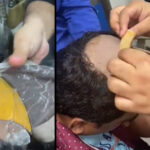 मलद्वार र तालुमा भेटियो आधा किलो सुन !