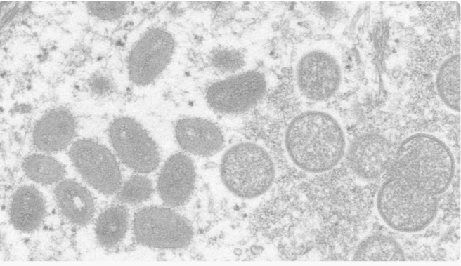 बेलायतमा यौन सम्पर्क नगर्न सरकारको निर्देशन